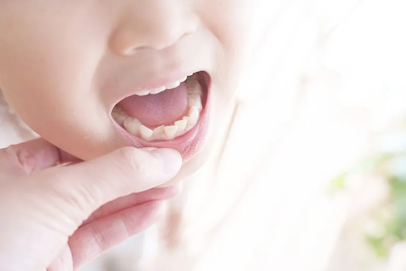 【大阪府堺市の矯正歯科】お子様の歯並びは日常の行動で変わります。